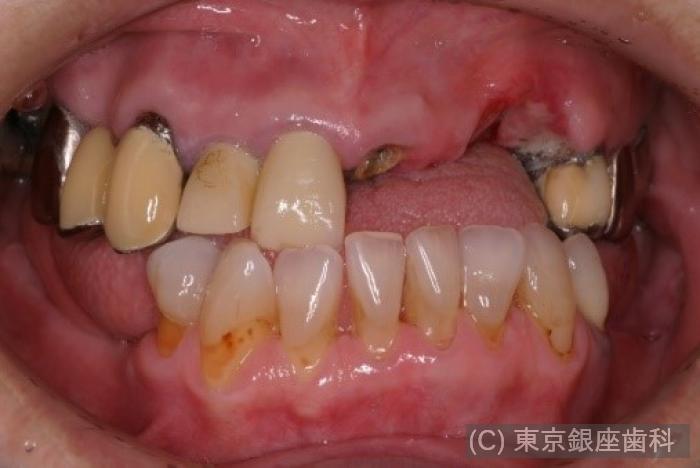 CASE01施術前