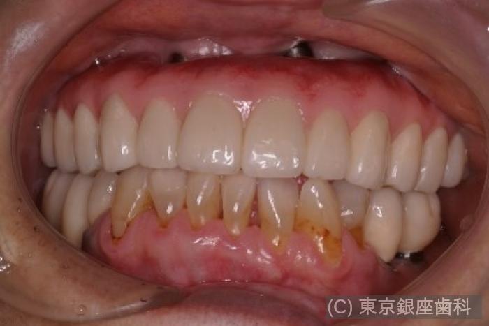CASE01施術後