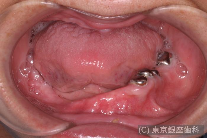 CASE01施術前