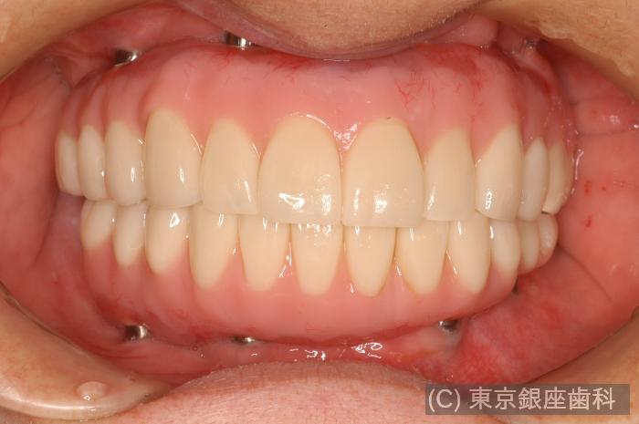 CASE01施術後