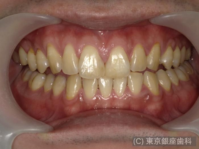 CASE01施術前