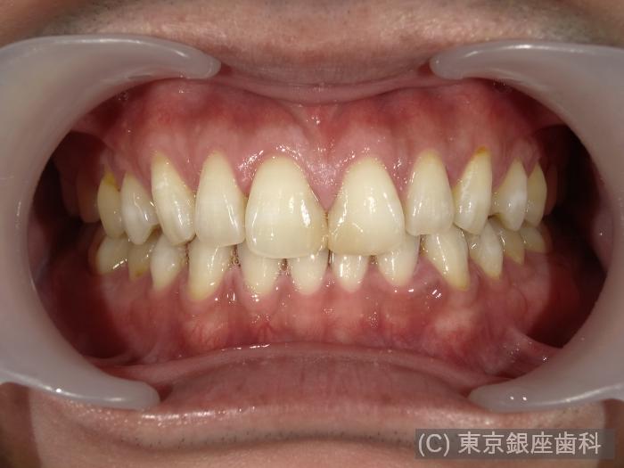 CASE01施術後