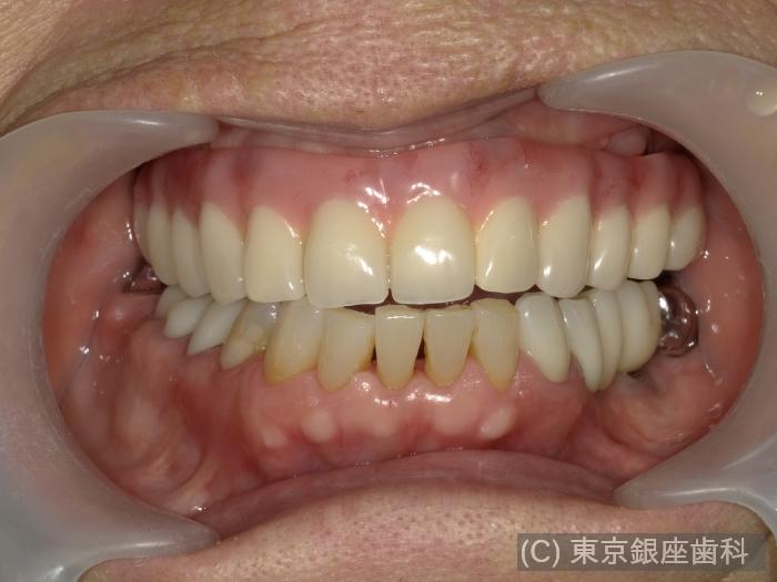 CASE01施術前