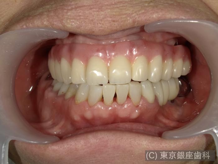 CASE01施術後