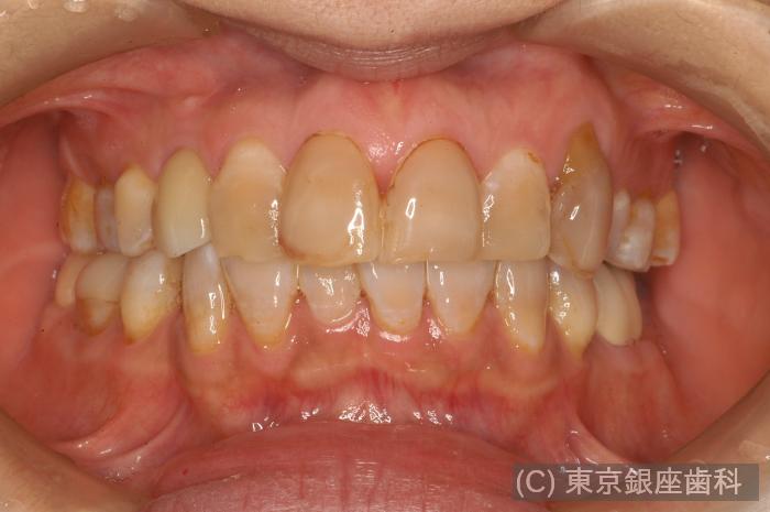 CASE01施術前