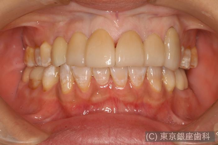 CASE01施術後