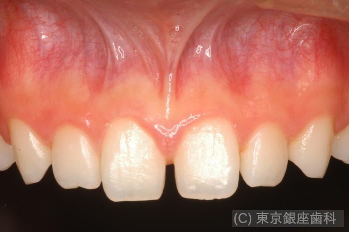 CASE01施術前