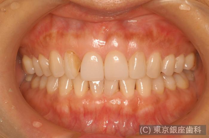 CASE01施術前