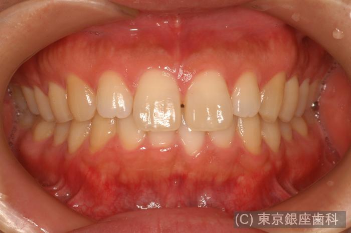 CASE01施術前