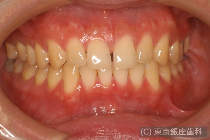 CASE01施術前